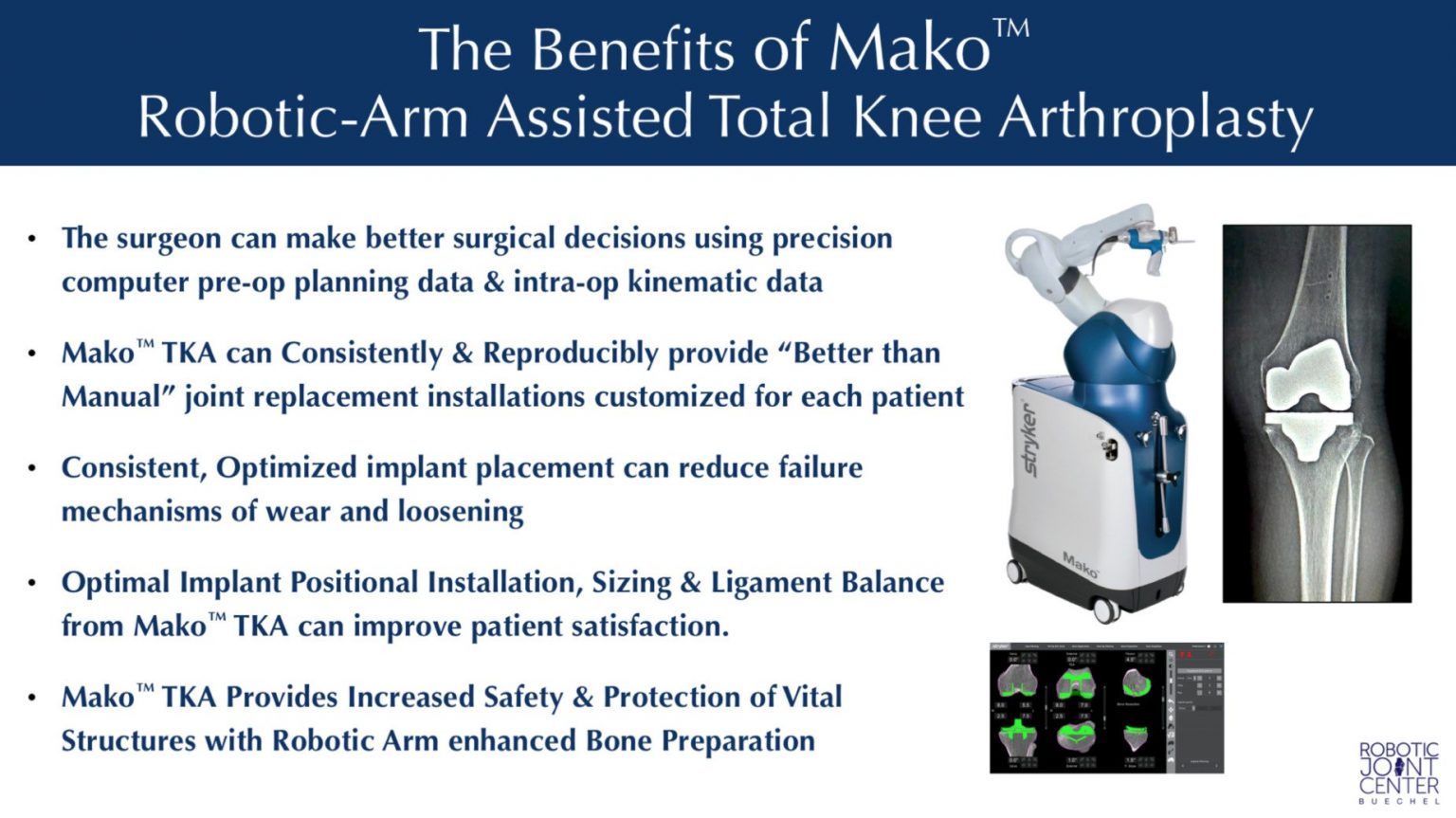 NYC Mako Robotic Total Knee Replacement Dr. Frederick Buechel, Jr.