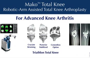 MAKO Robotic-Arm Presentation 