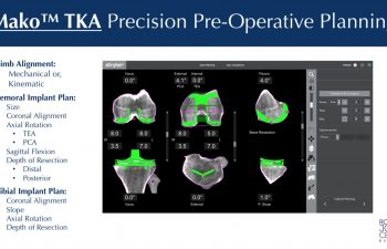 presentation slide