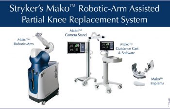 Mako™ Robotic Partial Knee Replacement System used by Dr. Buechel