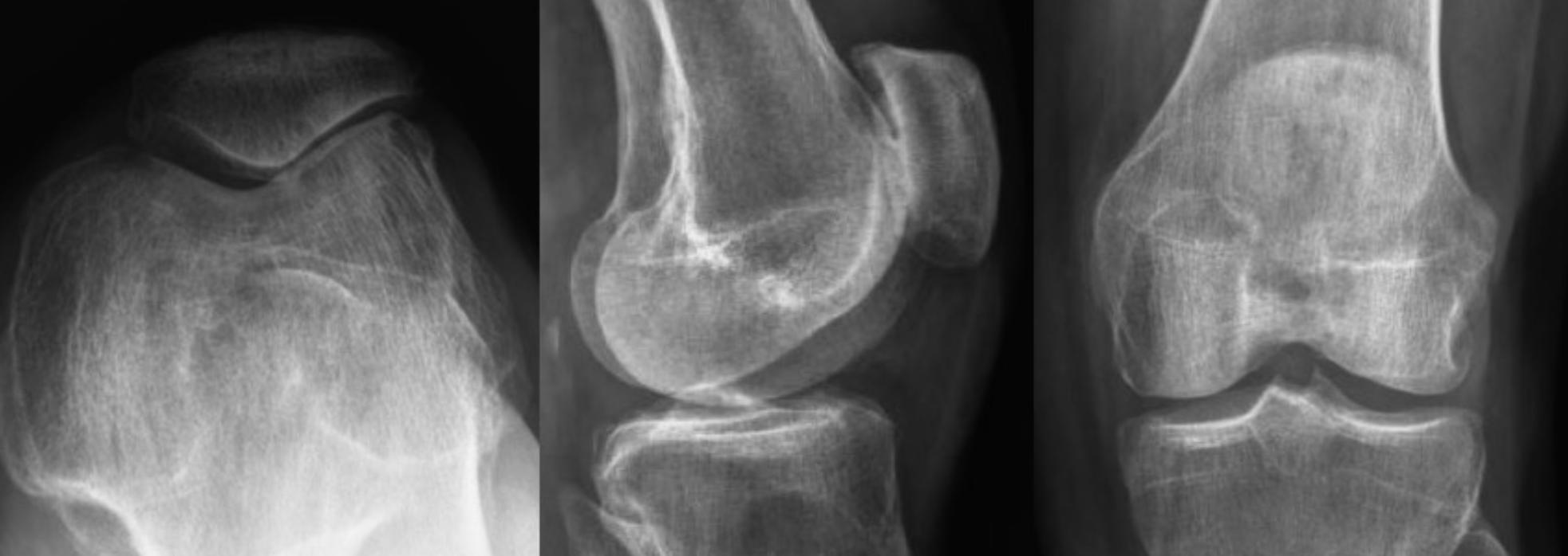 Knee x-rays