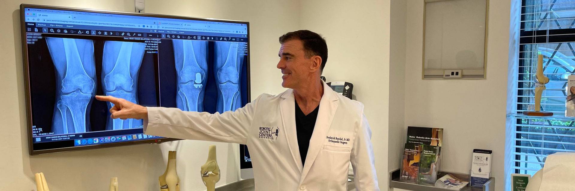 Dr. Buechel presenting pre and post-operative x-rays of his knee replacement patient.